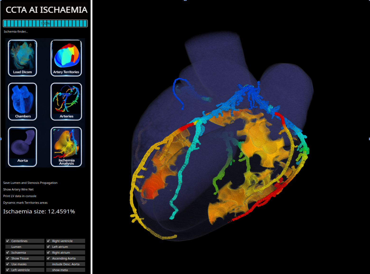 Desktop version – Ischaemia